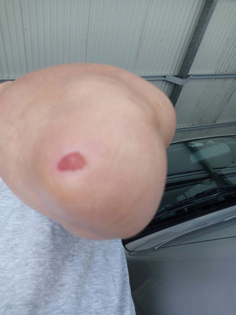 Bruno's Bne - Lismore Accommodation 3